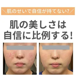 顧問医師提携サロン ENSOLEILLEのエステ・リラクイメージ