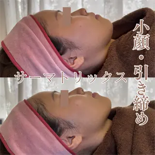 肌質改善フェイシャル 看護師 只野のエステ・リラクイメージ