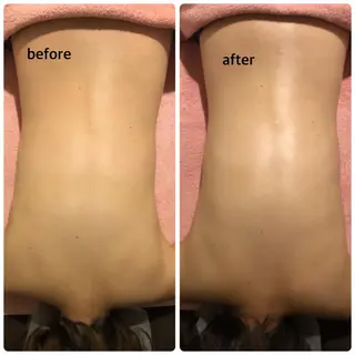 未病ケアサロン EMINY所属・未病ケアサロン EMINY☺︎勝俣のエステ・リラクイメージ