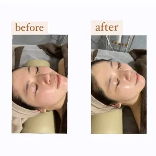 crescent所属・【韓国肌管理・脱毛】 クレセントのエステ・リラクイメージ