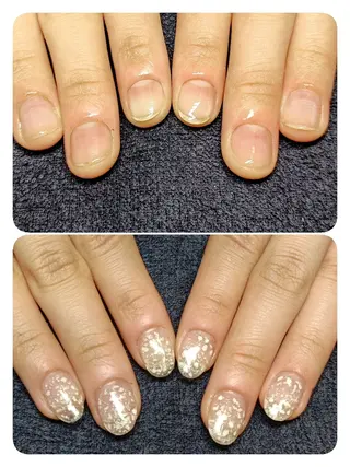 ネイル 深爪矯正/爪育成ケア manie nailのネイルデザイン