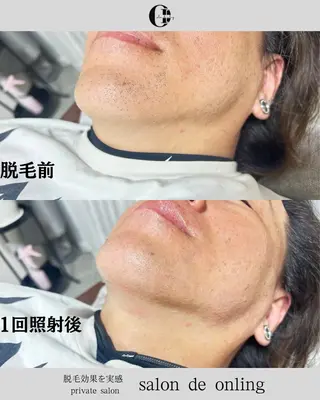 salon  de onlingのエステ・リラクイメージ