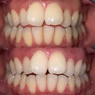 ホワイトニングサロンaile所属・セルフホワイトニング 金城しおりのその他イメージ