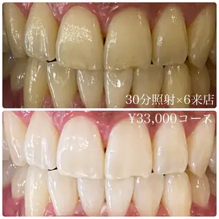 メンズ ホワイトニングルーム　川崎店所属・ホワイトニング ルーム　川崎店のその他イメージ