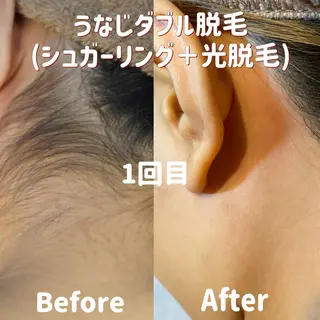 うなじラボ(UNAJI LABO)所属・池袋脱毛 さとうのエステ・リラクイメージ