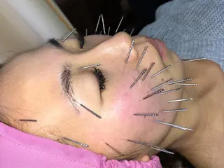 セントラル鍼灸院 Re:laxyのエステ・リラクイメージ