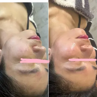 美容鍼灸サロン mahoroba院長のエステ・リラクイメージ