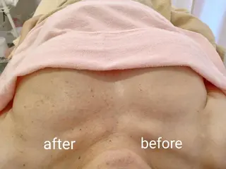 マシュマロバスト coucouのエステ・リラクイメージ