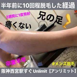 メンズ 脱毛＆エステサロン【アンリミット】所属・森谷 莉美のエステ・リラクイメージ