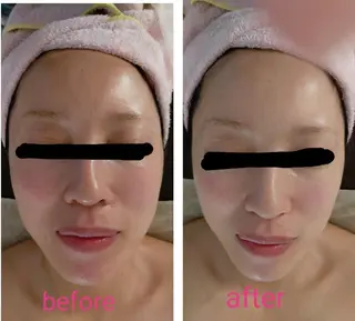 beauty salon    向日葵所属・beauty  salon 向日葵のエステ・リラクイメージ