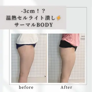 小顔矯正専門店 【RED】池田のエステ・リラクイメージ