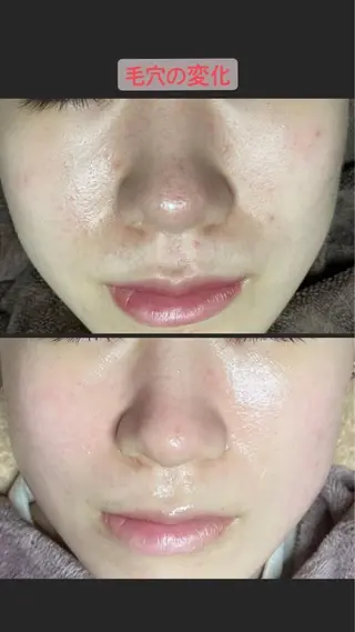 代表 MOMOの眉毛・アイブロウイメージ