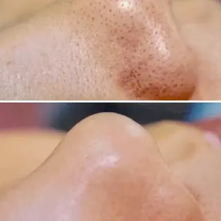 骨盤矯正フィジーク大宮所属・トータルビューティー 痩身&小顔専門店のエステ・リラクイメージ