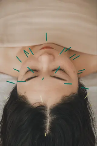 harimoon仙台所属・美容鍼灸＆美バスト harimoonのエステ・リラクイメージ