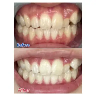 MBEAUTYSALON 千葉店・京成大久保所属・Melty 輝のその他イメージ