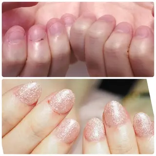 ネイル 深爪を断らない スカルプ高評価店のネイルデザイン