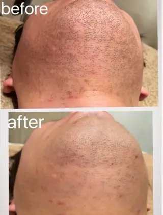 Feather TOMのエステ・リラクイメージ