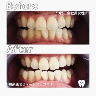 Whitening Beauty 市川妙典店所属・天根 春香のエステ・リラクイメージ