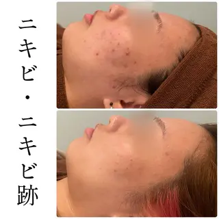 ハーブピーリング専門 BIOEL横浜のエステ・リラクイメージ