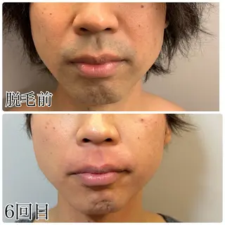 メンズ 毛穴洗浄特化🫧 オオツカのエステ・リラクイメージ