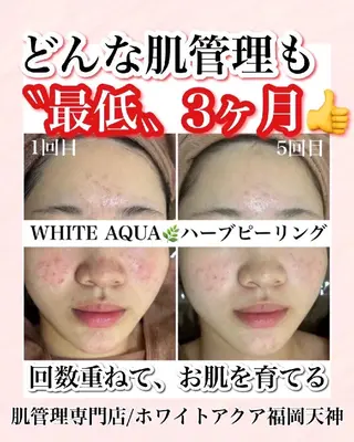 メンズ キッズ WHITEAQUA 福岡天神店のエステ・リラクイメージ