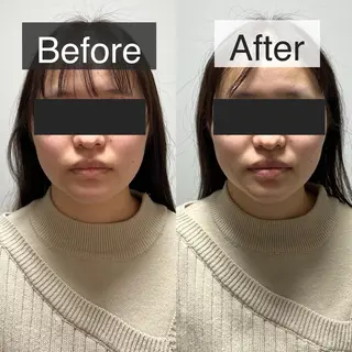 脱毛専門サロン BELFINE恵比寿のエステ・リラクイメージ