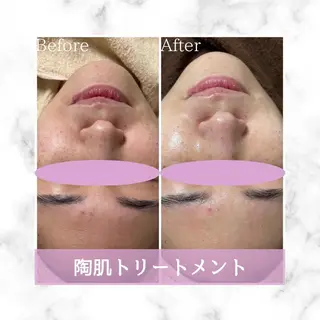 ロング カラー パーマ ヘアアレンジ メンズ キッズ ネイル マツエク・マツパ アイブロウ Amaryllis 🌹松本のエステ・リラクイメージ