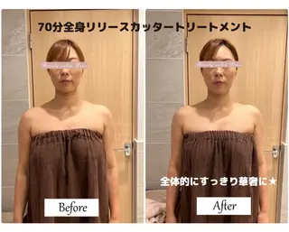 痩身×フェイシャル ブライダル|Linoのエステ・リラクイメージ