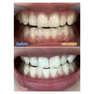 MBEAUTYSALON 千葉店・京成大久保所属・Melty 輝のその他イメージ