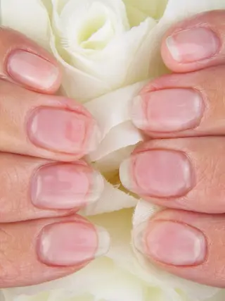 ネイル 深爪矯正/爪育成ケア manie nailのネイルデザイン