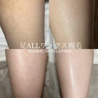 HOTEL&PARK .Moeワックス脱毛のエステ・リラクイメージ
