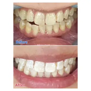 MBEAUTYSALON 千葉店・京成大久保所属・Melty 輝のその他イメージ