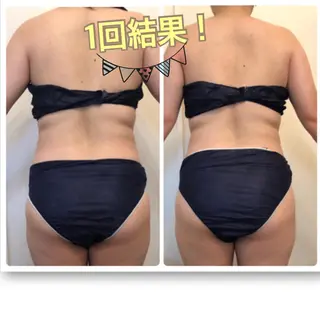 FLEUR大阪・美容 整体・痩身・小顔のエステ・リラクイメージ