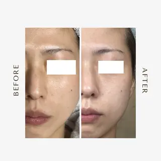 ROR所属・ROR nailのエステ・リラクイメージ