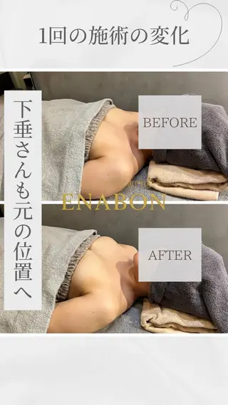 ENABON所属・バストアップ専門店 ENABON上野のエステ・リラクイメージ