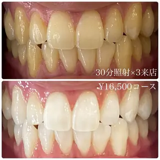 PLATINUM Beauty 横浜店所属・ホワイトニングルーム 横浜店のその他イメージ