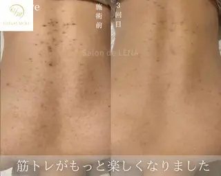 ハーブピーリング・毛穴ケア専門サロンSalon de LENA 栄店所属・ハーブピーリング専門 サロンドレナ　白藤のエステ・リラクイメージ