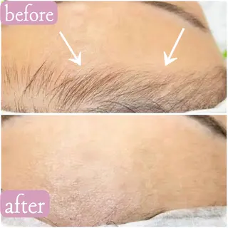 Total beauty salon  Brilliant所属・ブリリアント yuiのエステ・リラクイメージ