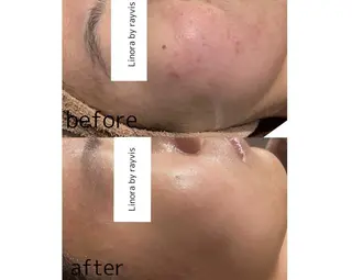 👑Linolaby RAYVIS👑⭐️のエステ・リラクイメージ