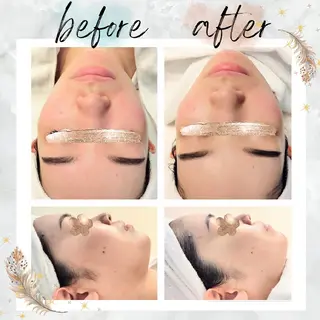NARIS beautysalon 所属・Takahashi  Hiromiのエステ・リラクイメージ