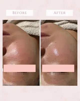 Ricerca ビューティーサロンのエステ・リラクイメージ