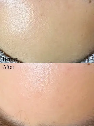 Hit. シュガーリング豊橋のエステ・リラクイメージ