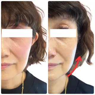 Astorie 相模大野エステのその他イメージ