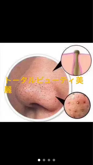 トータルビューティ美麗所属・トータルビューティ 美麗のエステ・リラクイメージ