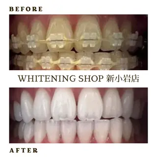 ホワイトニング ショップ新小岩店のその他イメージ