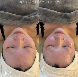 うなじ脱毛/美肌脱毛 LABELのエステ・リラクイメージ