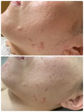 Natsu *メンズネイリストのネイルデザイン