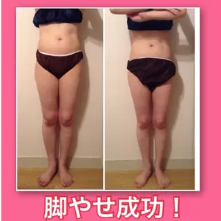 小尻・太もも痩せる エステルナボーテのエステ・リラクイメージ