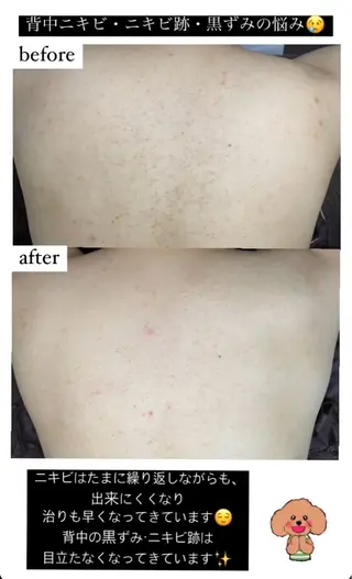 ベラージュ【美背中・ 美尻・フェイシャル】のエステ・リラクイメージ