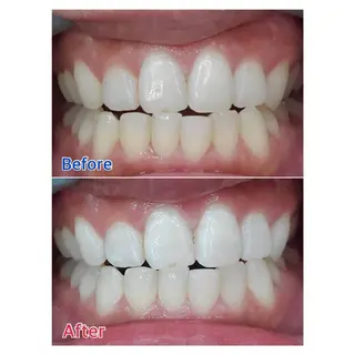 MBEAUTYSALON 千葉店・京成大久保所属・Melty 輝のその他イメージ